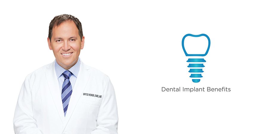What are the benefits of dental implants in Roswell, NM